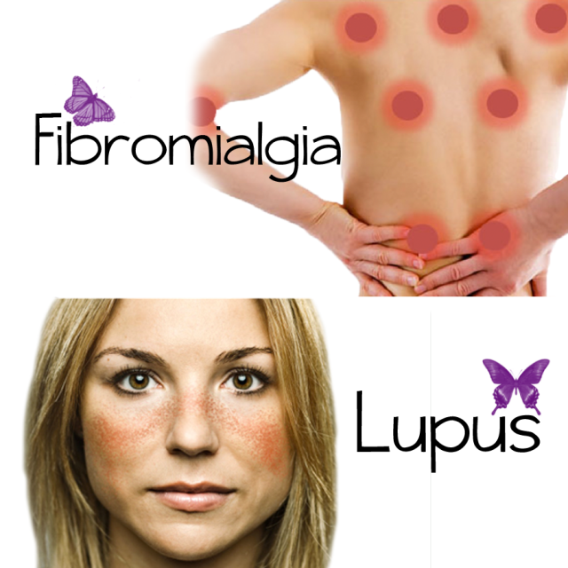 lupus og fm