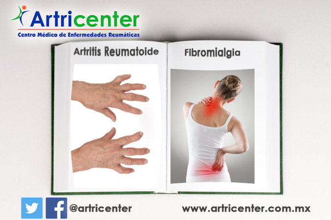artritis-fibromialgia-artricenter