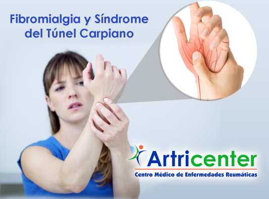 Fibromialgia-TúnelCarpiano-artricenter.png